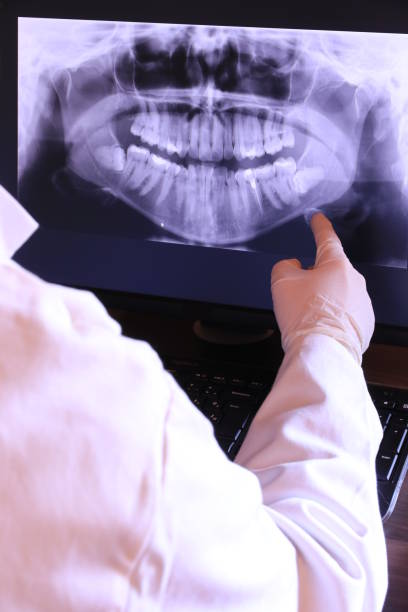 Best Emergency Tooth Extraction in Cashmere, WA
