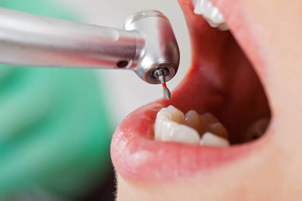 Best Weekend Emergency Dentist in Cashmere, WA
